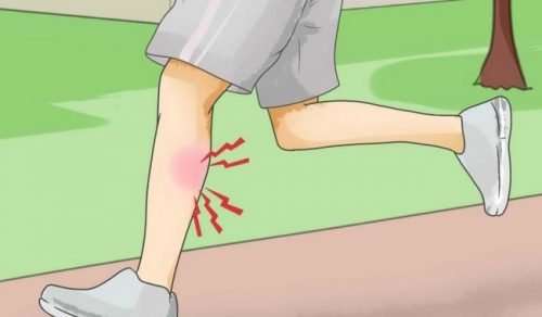 A Cramp? This Is What You Should Do to Get Rid of It