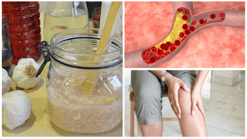 Reduce Both Cholesterol and Joint Pain with this Natural Syrup Reduce Both Cholesterol and Joint Pain with this Natural Syrup