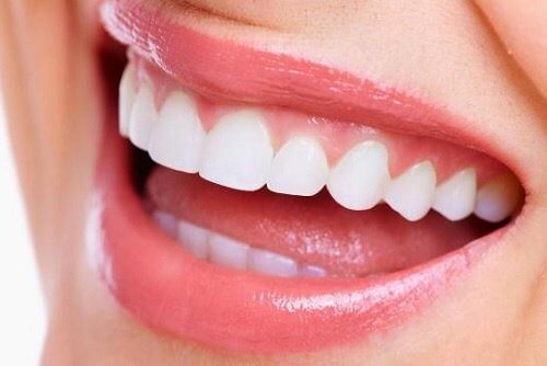 A lady with very white teeth.