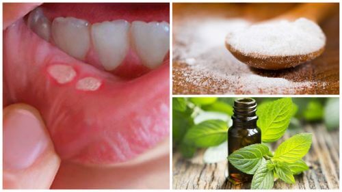 7 Natural Remedies for Mouth Sores