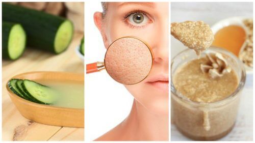 Help Shrink Your Pores with These 5 Natural Remedies