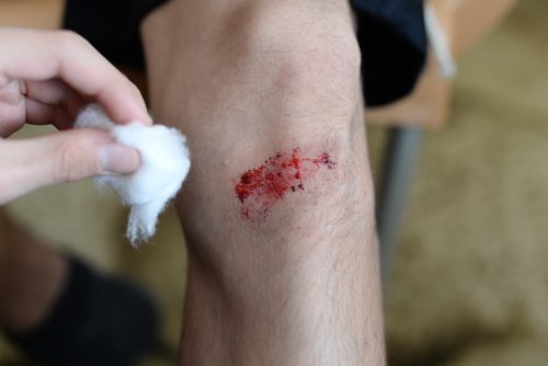 A person attending a wound.