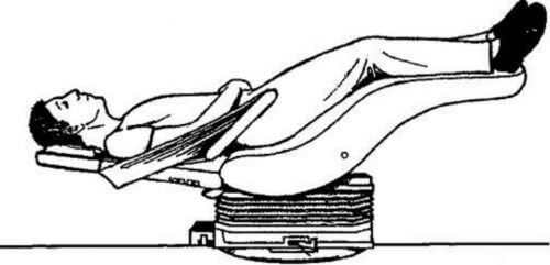 Vagushermo aktivoidaan Trendelenburg-asennossa