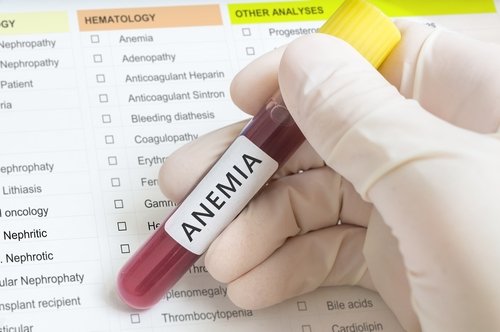 Anemia.