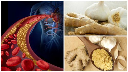 Ginger and Garlic Remedy for High Blood Pressure and Cholesterol