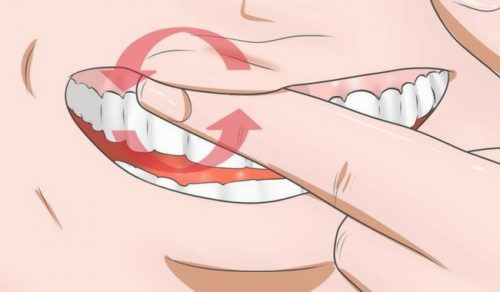 Combat Swollen Gums With These 8 Home Remedies