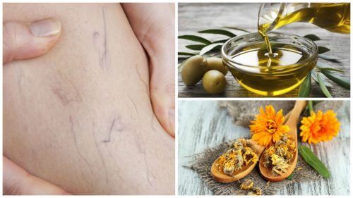 Improve the Appearance of Varicose Veins with Olive Oil and Marigold