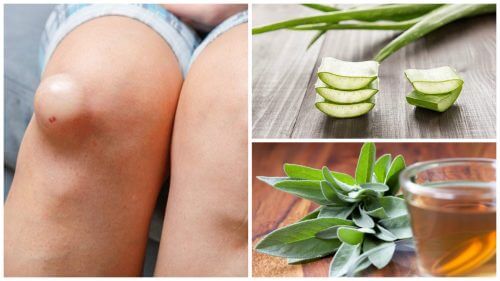 Anti-inflammatory remedies to reduce knee fluid