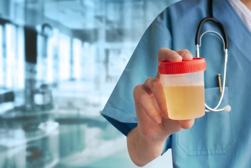A nurse holds a jar of urine.