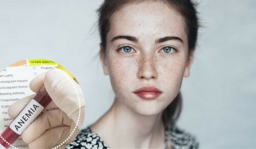 Can Anemia Affect Your Emotions?