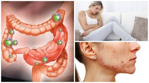 Intestinal Bacteria Imbalance Leads to These 6 Problems