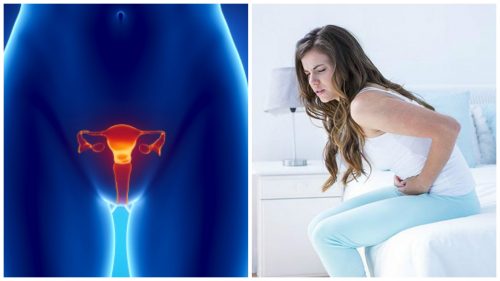 7 Important Facts About Ovarian Cancer