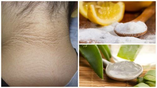 5 Skin-Care Treatments to Lighten Dark Patches On Your Neck 5 Skin-Care Treatments to Lighten Dark Patches On Your Neck