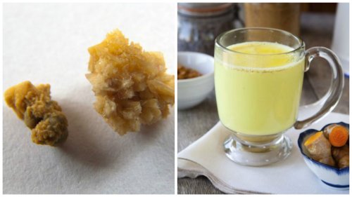 Combat Kidney Stones with Ginger and Turmeric Tea