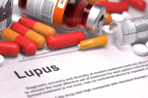 What You Should Know About Lupus