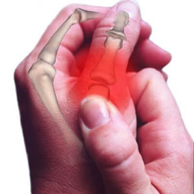 Person experiencing joint pain in their hand