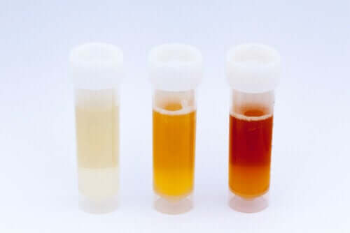 What the Color of Urine Says About Your Health
