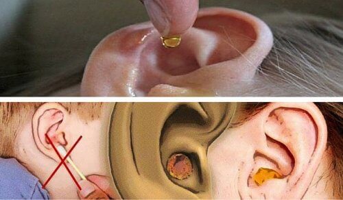How to clean your ears.