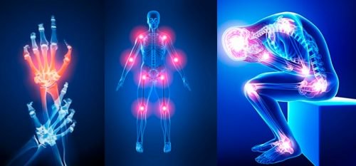 Causes of Joint Pain - Seven Possible Reasons
