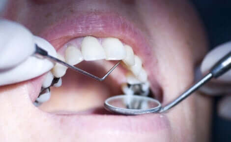 A person at the dentist.
