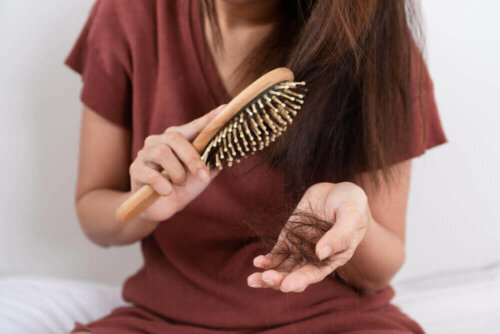 A woman with hair loss.
