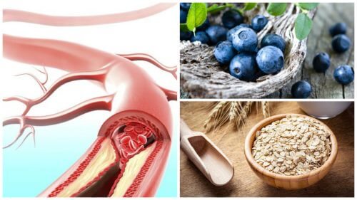 9 Foods that Can Improve Your Arterial Health