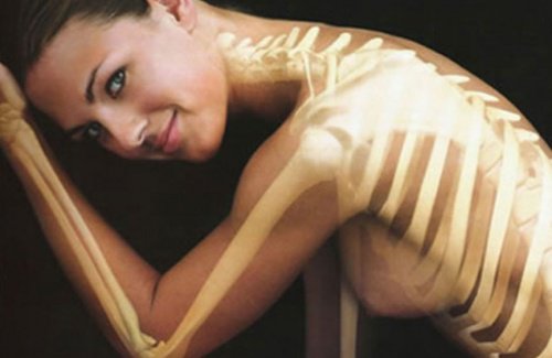 weak bones