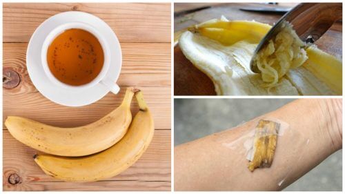 5 Ways to Use Banana Peel as a Natural Remedy