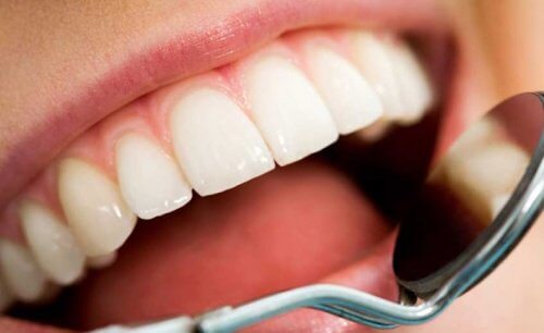 A lady on a visit to the dentist.