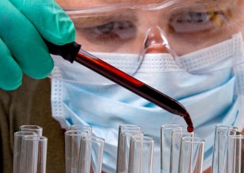 Your doctor can test for hypothyroidism