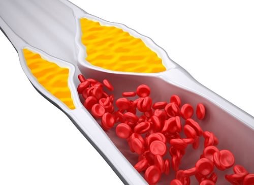 4 Smoothies to Control Your Cholesterol Levels 4 Smoothies to Control Your Cholesterol Levels