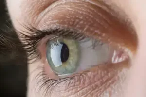 7 Tips for Improving Your Vision Naturally Without Surgery