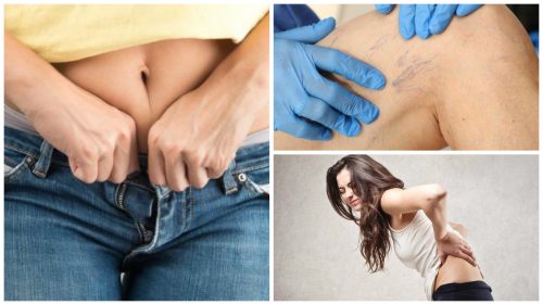 9 Problems Caused By Tight Clothes