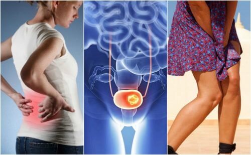 7 Signs of Bladder Cancer to Watch Out For