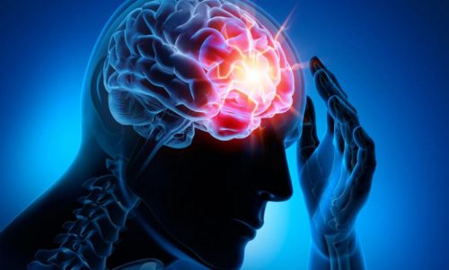 The Four Most Common Cerebrovascular Diseases