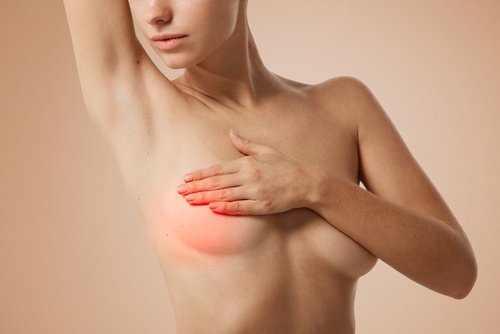 A woman with mastitis.