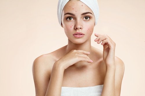 A woman using baking soda and honey for acne.