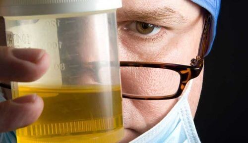 Urine Smells Bad for These Eight Reasons