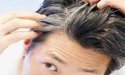 6 Vitamins and Foods to Avoid Going Gray Early
