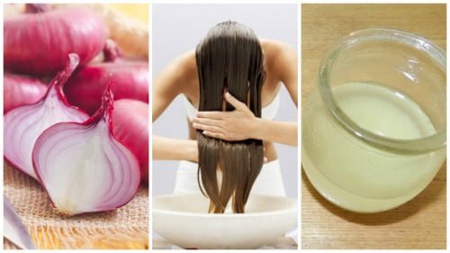 How to Tackle Hair Loss with Onion-based Remedies