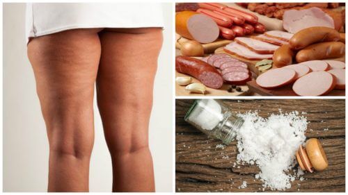 Avoid These 7 Foods If You Have Cellulite