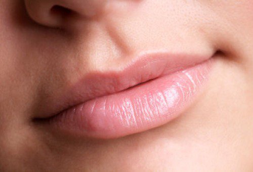 upper lip with a v