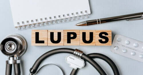 Characteristics of Systemic Lupus Erythematosus