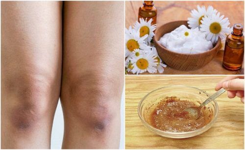 Lighten the Skin on Your Knees with These 5 Natural Exfoliants Lighten the Skin on Your Knees with These 5 Natural Exfoliants