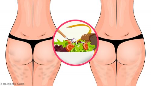 How to Reduce Cellulite by Eating a Healthy Diet