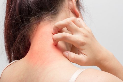 Intestinal problems may manifest in skin rashes