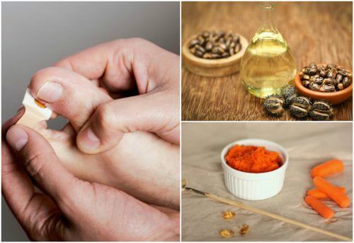 Get Rid of Hangnails with These 8 Natural Treatments