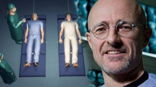 Is a Head Transplant Really Going to Happen?