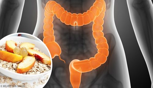 Here’s What to Eat to Treat Irritable Bowel Syndrome