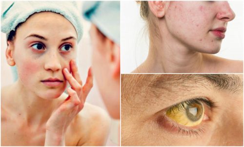 7 Possible Signs of a Nutrient Deficiency You'll See on Your Face